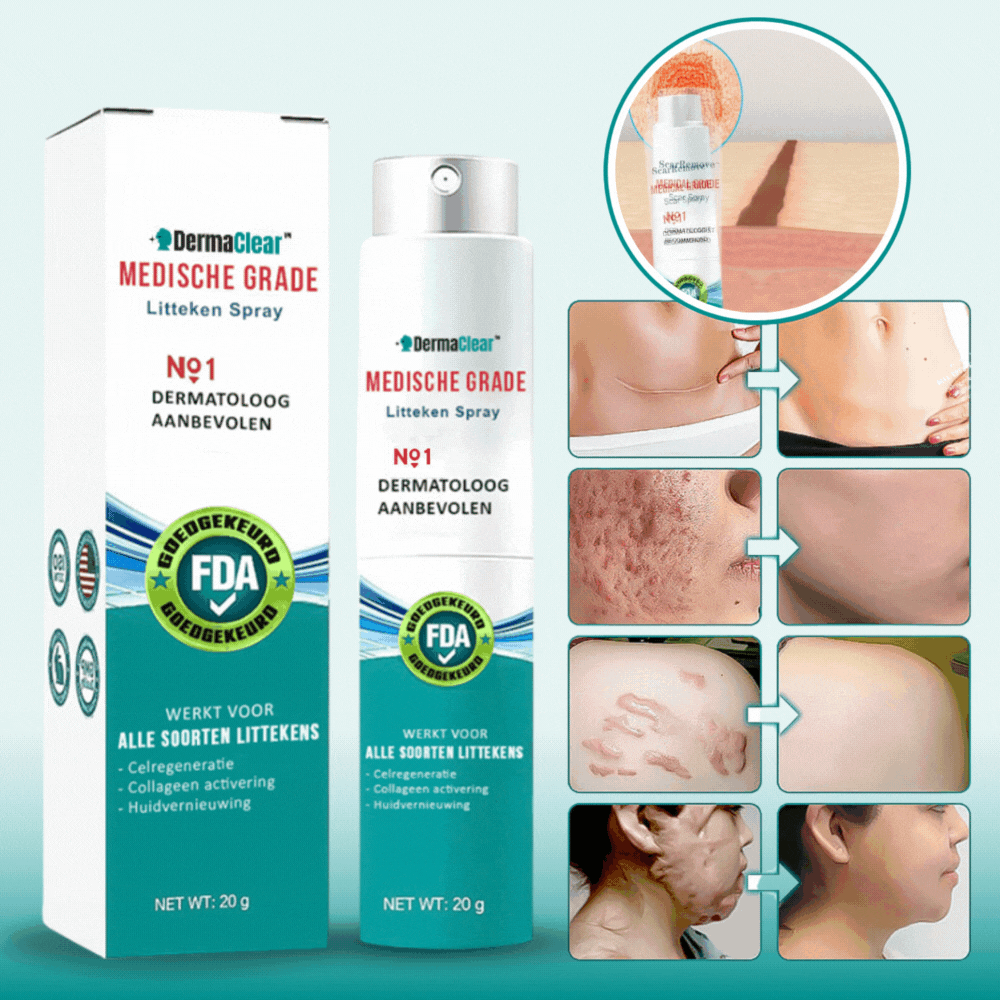 DermaClear™ - Geavanceerde litteken spray