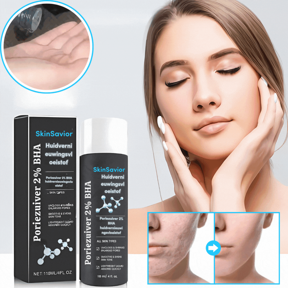 SkinSavior™ | 2% BHA huidvernieuwingsvloeistof, Verwijdert acne littekens met 80% in 4 weken